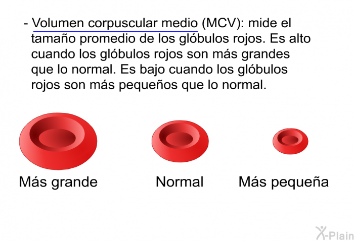 <B>Volumen corpuscular medio (MCV):</B> mide el tama�o promedio de los gl�bulos rojos. Es alto cuando los gl�bulos rojos son m�s grandes que lo normal. Es bajo cuando los gl�bulos rojos son m�s peque�os que lo normal.