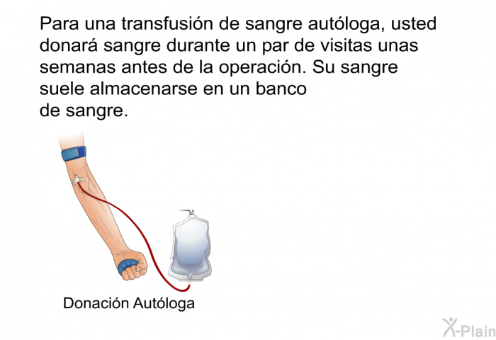 Para una transfusin de sangre autloga, usted donar sangre durante un par de visitas unas semanas antes de la operacin. Su sangre suele almacenarse en un banco de sangre.