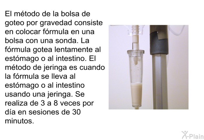 El mtodo de la bolsa de goteo por gravedad consiste en colocar frmula en una bolsa con una sonda. La frmula gotea lentamente al estmago o al intestino. El mtodo de jeringa es cuando la frmula se lleva al estmago o al intestino usando una jeringa. Se realiza de 3 a 8 veces por da en sesiones de 30 minutos.