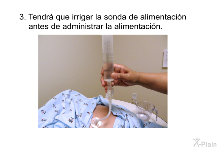 Tendr que irrigar la sonda de alimentacin antes de administrar la alimentacin.