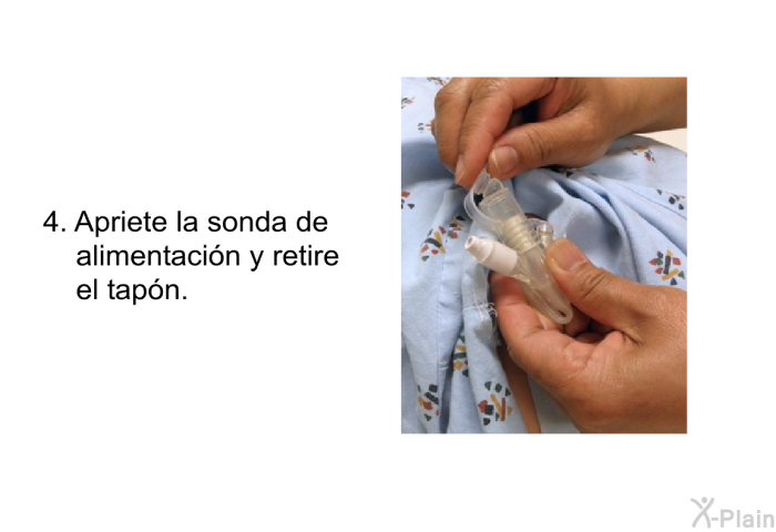 Apriete la sonda de alimentacin y retire el tapn.