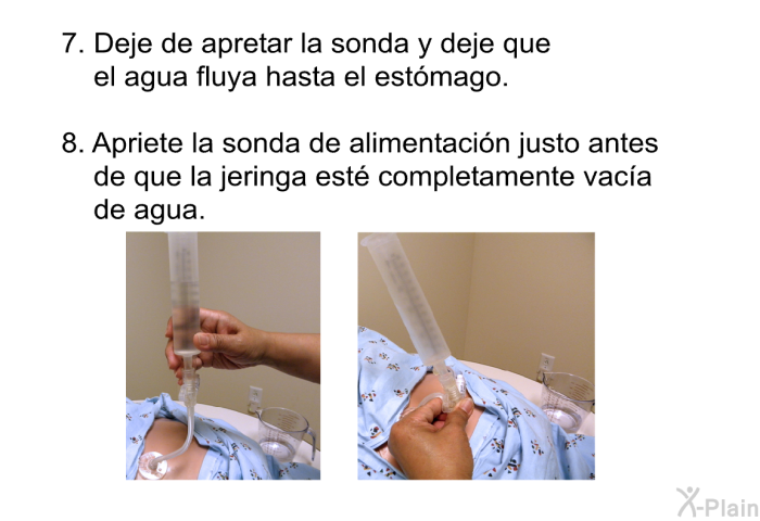 Deje de apretar la sonda y deje que el agua fluya hasta el estmago.  Apriete la sonda de alimentacin justo antes de que la jeringa est completamente vaca de agua.