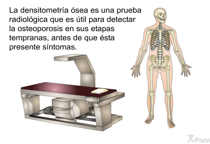 La densitometra sea es una prueba radiolgica que es til para detectar la osteoporosis en sus etapas tempranas, antes de que sta presente sntomas.