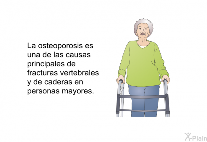La osteoporosis es una de las causas principales de fracturas vertebrales y de caderas en personas mayores.