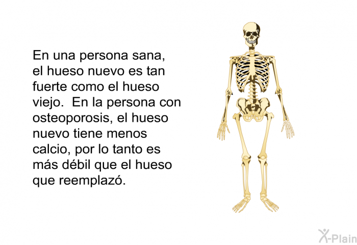 En una persona sana, el hueso nuevo es tan fuerte como el hueso viejo. En la persona con osteoporosis, el hueso nuevo tiene menos calcio, por lo tanto es ms dbil que el hueso que reemplaz.