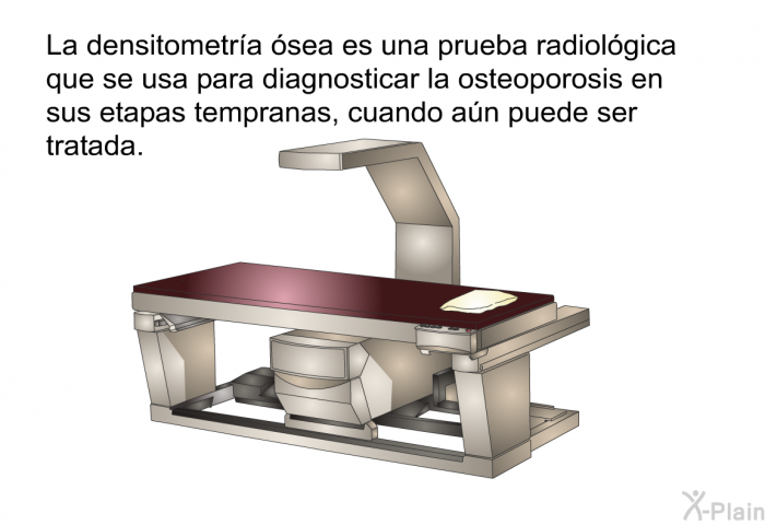 La densitometra sea es una prueba radiolgica que se usa para diagnosticar la osteoporosis en sus etapas tempranas, cuando an puede ser tratada.