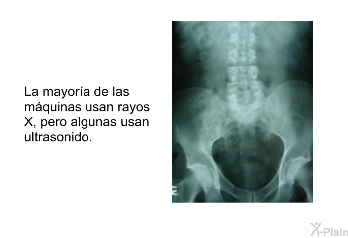 La mayora de las mquinas usan rayos X, pero algunas usan ultrasonido.