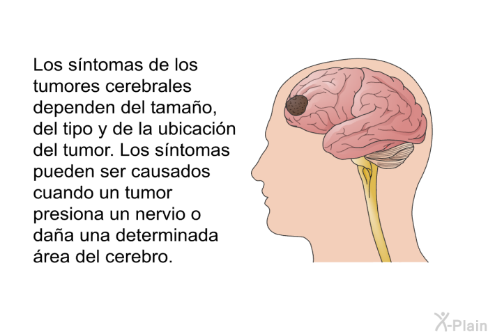 Los sntomas de los tumores cerebrales dependen del tamao, del tipo y de la ubicacin del tumor. Los sntomas pueden ser causados cuando un tumor presiona un nervio o daa una determinada rea del cerebro.