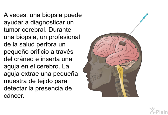 A veces, una biopsia puede ayudar a diagnosticar un tumor cerebral. Durante una biopsia, un profesional de la salud perfora un peque�o orificio a trav�s del cr�neo e inserta una aguja en el cerebro. La aguja extrae una peque�a muestra de tejido para detectar la presencia de c�ncer.