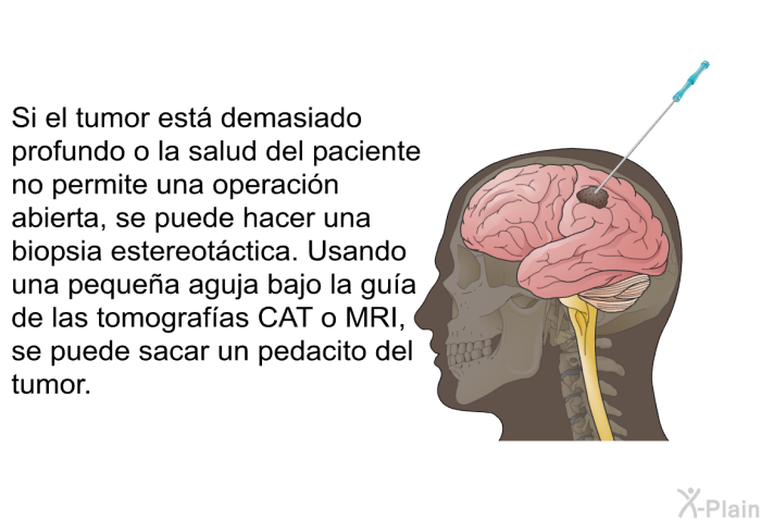 Si el tumor est� demasiado profundo o la salud del paciente no permite una operaci�n abierta, se puede hacer una biopsia estereot�ctica. Usando una peque�a aguja bajo la gu�a de las tomograf�as CAT o MRI, se puede sacar un pedacito del tumor.
