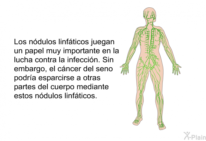 Los ndulos linfticos juegan un papel muy importante en la lucha contra la infeccin. Sin embargo, el cncer del seno podra esparcirse a otras partes del cuerpo mediante estos ndulos linfticos.