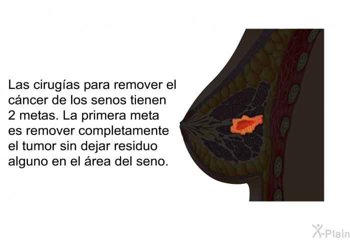 Las cirugas para remover el cncer de los senos tienen 2 metas. La primera meta es remover completamente el tumor sin dejar residuo alguno en el rea del seno.