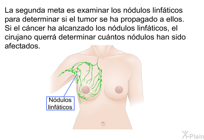 La segunda meta es examinar los ndulos linfticos para determinar si el tumor se ha propagado a ellos. Si el cncer ha alcanzado los ndulos linfticos, el cirujano querr determinar cuntos ndulos han sido afectados.