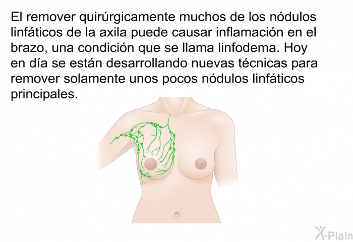 El remover quirrgicamente muchos de los ndulos linfticos de la axila puede causar inflamacin en el brazo, una condicin que se llama linfodema. Hoy en da se estn desarrollando nuevas tcnicas para remover solamente unos pocos ndulos linfticos principales.