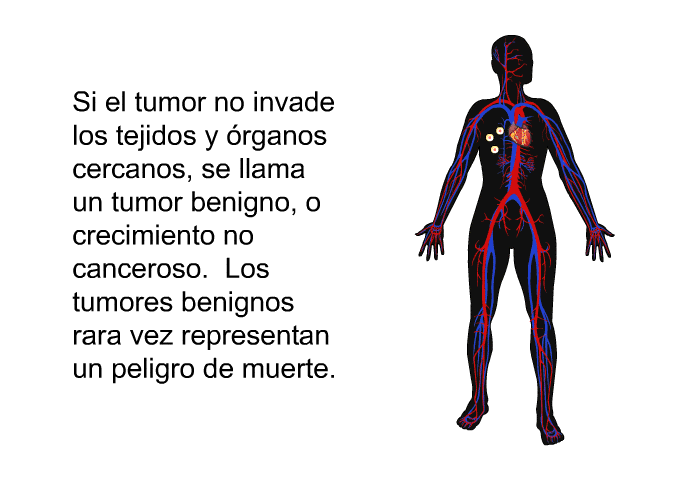 Si el tumor no invade los tejidos y rganos cercanos, se llama un tumor benigno, o crecimiento no canceroso. Los tumores benignos rara vez representan un peligro de muerte.