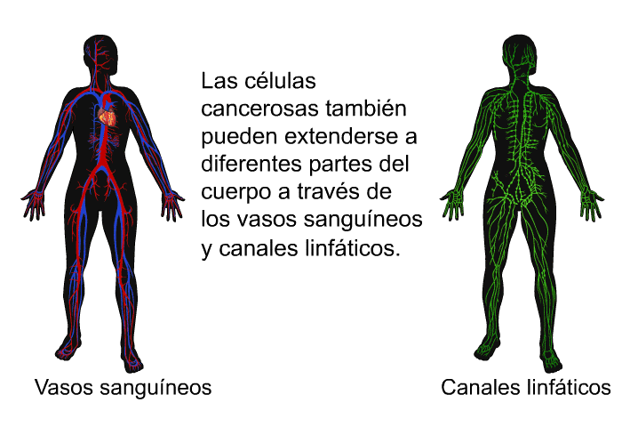 Las clulas cancerosas tambin pueden extenderse a diferentes partes del cuerpo a travs de los vasos sanguneos y canales linfticos.