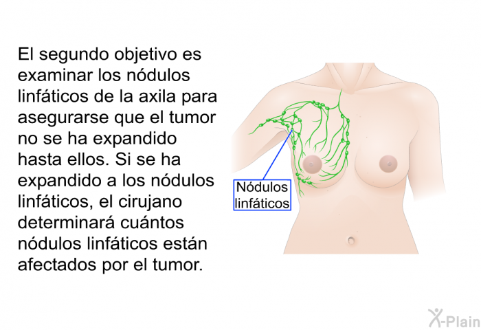 El segundo objetivo es examinar los ndulos linfticos de la axila para asegurarse que el tumor no se ha expandido hasta ellos. Si se ha expandido a los ndulos linfticos, el cirujano determinar cuntos ndulos linfticos estn afectados por el tumor.