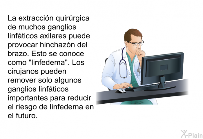 La extraccin quirrgica de muchos ganglios linfticos axilares puede provocar hinchazn del brazo. Esto se conoce como “linfedema”. Los cirujanos pueden remover solo algunos ganglios linfticos importantes para reducir el riesgo de linfedema en el futuro.