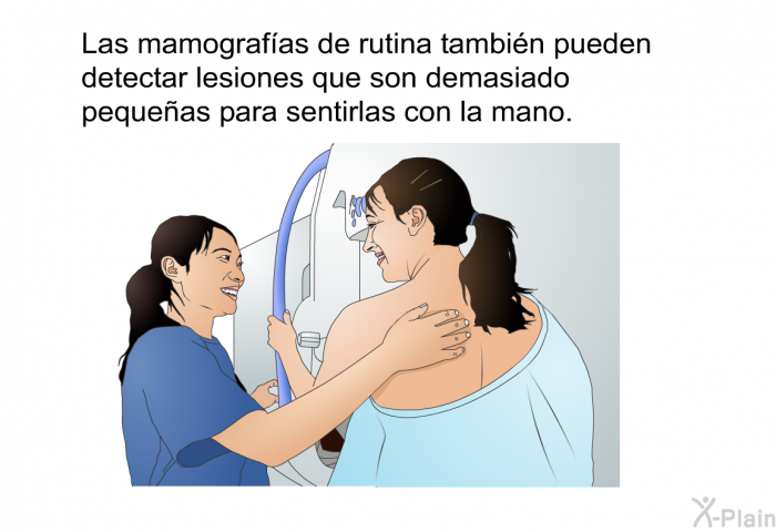 Las mamografas de rutina tambin pueden detectar lesiones que son demasiado pequeas para sentirlas con la mano.