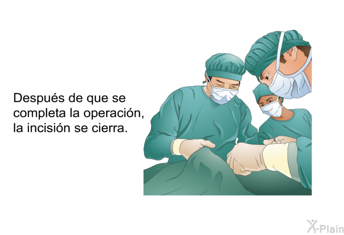 Despus de que se completa la operacin, la incisin se cierra.