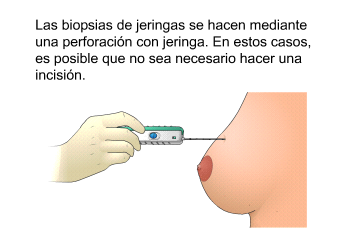 Las biopsias de jeringas se hacen mediante una perforacin con jeringa. En estos casos, es posible que no sea necesario hacer una incisin.