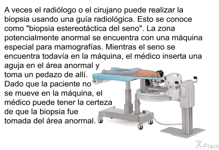 A veces el radilogo o el cirujano puede realizar la biopsia usando una gua radiolgica. Esto se conoce como “biopsia estereotctica del seno”. La zona potencialmente anormal se encuentra con una mquina especial para mamografas. Mientras el seno se encuentra todava en la mquina, el mdico inserta una aguja en el rea anormal y toma un pedazo de all. Dado que la paciente no se mueve en la mquina, el mdico puede tener la certeza de que la biopsia fue tomada del rea anormal.