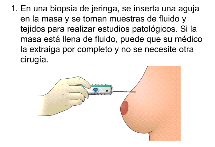 En una biopsia de jeringa, se inserta una aguja en la masa y se toman muestras de fluido y tejidos para realizar estudios patolgicos. Si la masa est llena de fluido, puede que su mdico la extraiga por completo y no se necesite otra ciruga.
