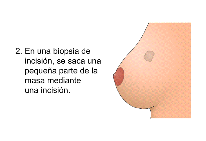 En una biopsia de incisin, se saca una pequea parte de la masa mediante una incisin.