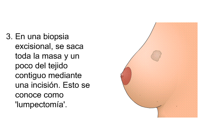 En una biopsia excisional, se saca toda la masa y un poco del tejido contiguo mediante una incisin. Esto se conoce como  lumpectoma'.