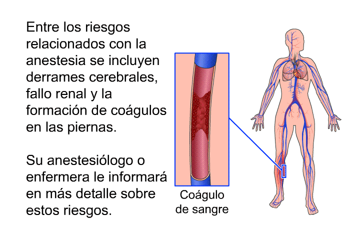 Entre los riesgos relacionados con la anestesia se incluyen derrames cerebrales, fallo renal y la formacin de cogulos en las piernas. Su anestesilogo o enfermera le informar en ms detalle sobre estos riesgos.