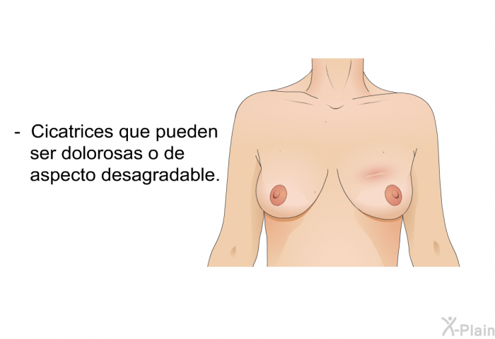 Cicatrices que pueden ser dolorosas o de aspecto desagradable.