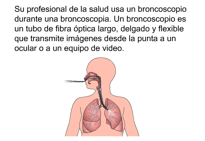 Su profesional de la salud usa un broncoscopio durante una broncoscopia. Un broncoscopio es un tubo de fibra ptica largo, delgado y flexible que transmite imgenes desde la punta a un ocular o a un equipo de video.