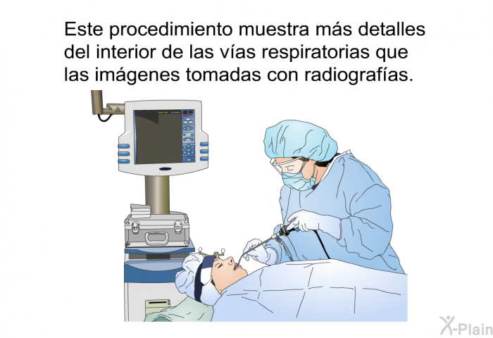 Este procedimiento muestra ms detalles del interior de las vas respiratorias que las imgenes tomadas con radiografas.