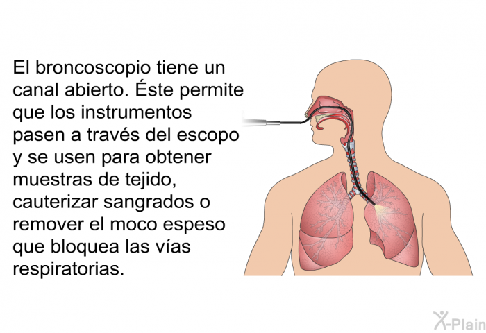 El broncoscopio tiene un canal abierto. Éste permite que los instrumentos pasen a travs del escopo y se usen para obtener muestras de tejido, cauterizar sangrados o remover el moco espeso que bloquea las vas respiratorias.