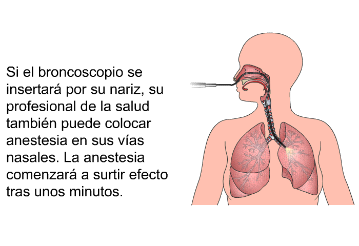 Si el broncoscopio se insertar por su nariz, su profesional de la salud tambin puede colocar anestesia en sus vas nasales. La anestesia comenzar a surtir efecto tras unos minutos.