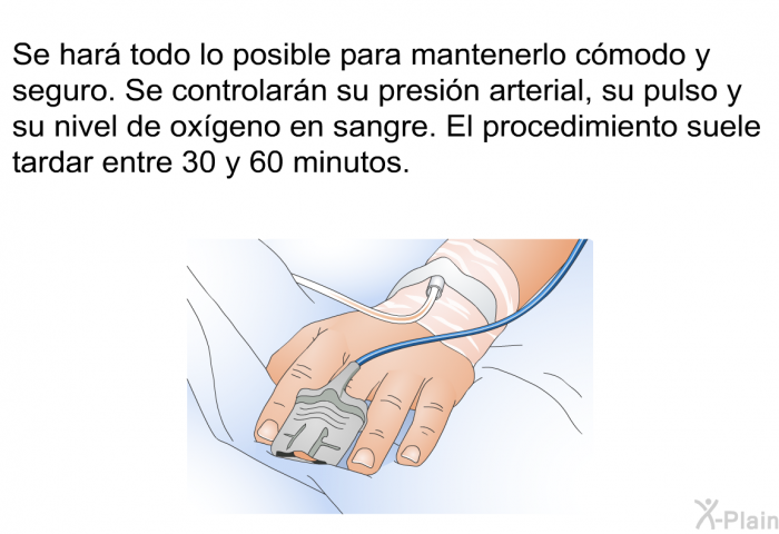 Se har todo lo posible para mantenerlo cmodo y seguro. Se controlarn su presin arterial, su pulso y su nivel de oxgeno en sangre. El procedimiento suele tardar entre 30 y 60 minutos.
