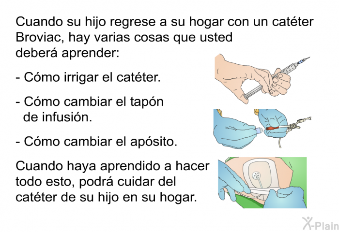 Cuando su hijo regrese a su hogar con un catter Broviac, hay varias cosas que usted deber aprender:  Cmo irrigar el catter. Cmo cambiar el tapn de infusin. Cmo cambiar el apsito.  
Cuando haya aprendido a hacer todo esto, podr cuidar del catter de su hijo en su hogar.