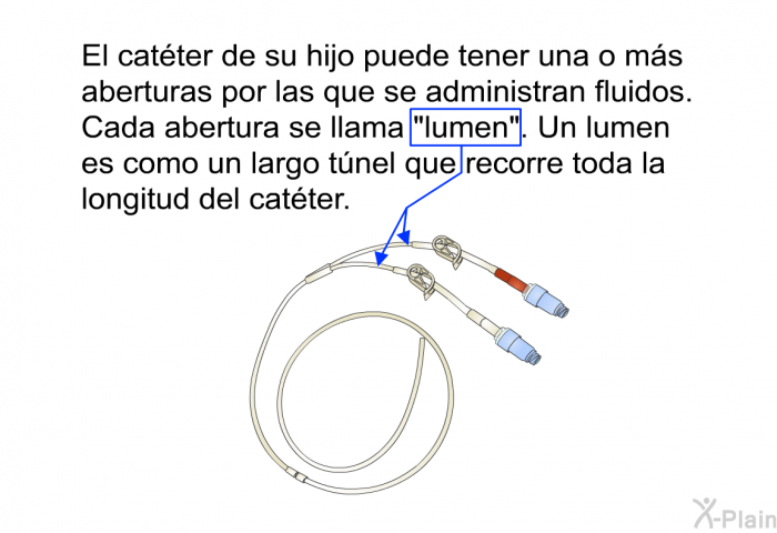 El catter de su hijo puede tener una o ms aberturas por las que se administran fluidos. Cada abertura se llama “lumen”. Un lumen es como un largo tnel que recorre toda la longitud del catter.