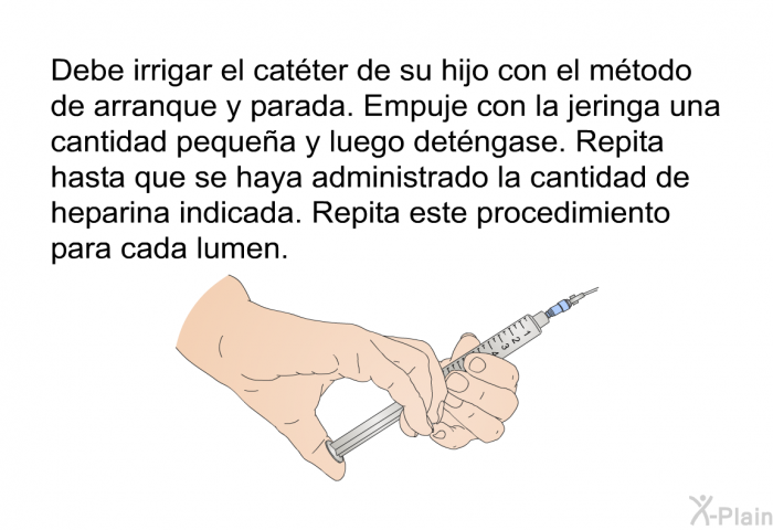 Debe irrigar el catter de su hijo con el mtodo de arranque y parada. Empuje con la jeringa una cantidad pequea y luego detngase. Repita hasta que se haya administrado la cantidad de heparina indicada. Repita este procedimiento para cada lumen.