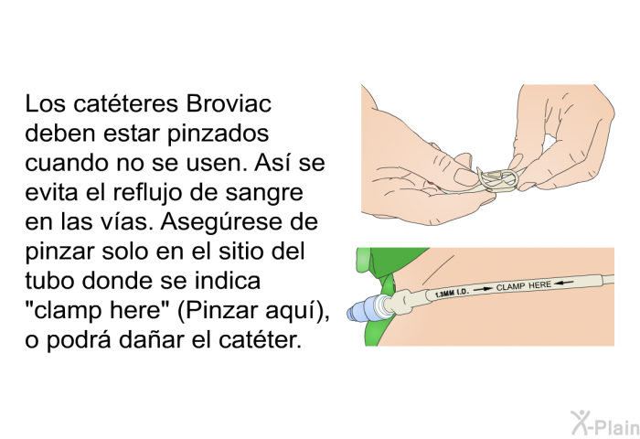 Los catteres Broviac deben estar pinzados cuando no se usen. As se evita el reflujo de sangre en las vas. Asegrese de pinzar solo en el sitio del tubo donde se indica “clamp here” (Pinzar aqu), o podr daar el catter.