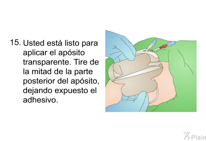 <OL START=15> Usted est listo para aplicar el apsito transparente. Tire de la mitad de la parte posterior del apsito, dejando expuesto el adhesivo.