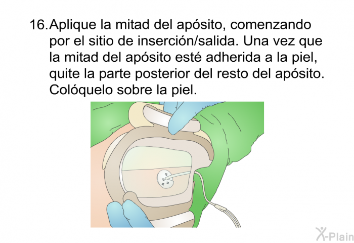 <OL START=16> Aplique la mitad del apsito, comenzando por el sitio de insercin/salida. Una vez que la mitad del apsito est adherida a la piel, quite la parte posterior del resto del apsito. Colquelo sobre la piel.