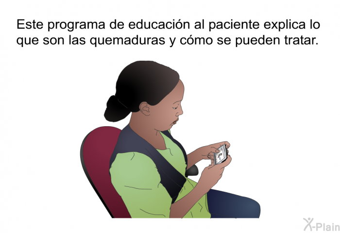 Esta informacin acerca de su salud explica lo que son las quemaduras y cmo se pueden tratar.