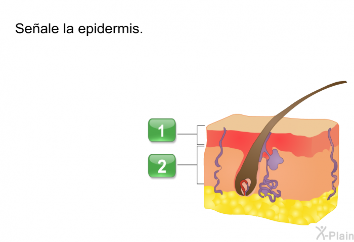 Seale la epidermis.