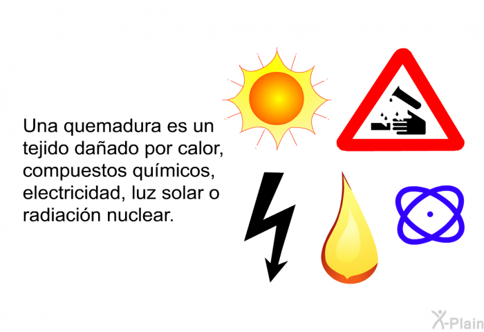 Una quemadura es un tejido daado por calor, compuestos qumicos, electricidad, luz solar o radiacin nuclear.
