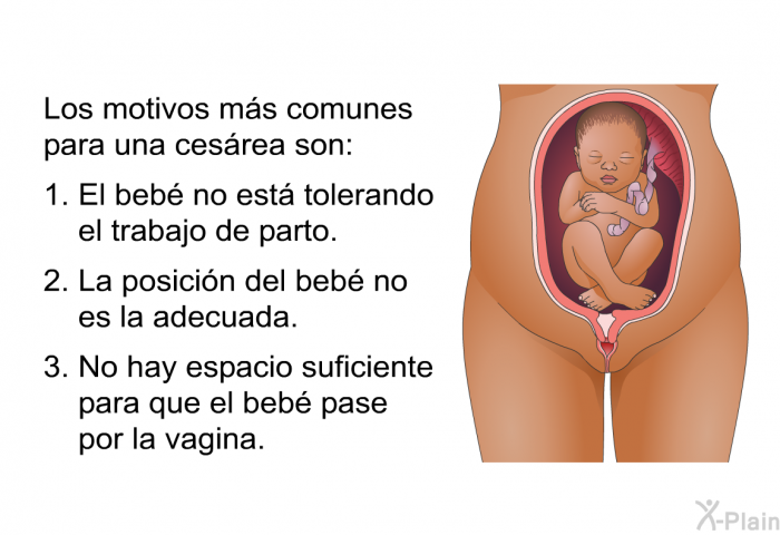 Los motivos ms comunes para una cesrea son:  El beb no est tolerando el trabajo de parto. La posicin del beb no es la adecuada. No hay espacio suficiente para que el beb pase por la vagina.