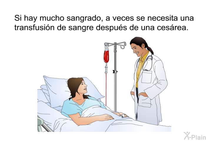 Si hay mucho sangrado, a veces se necesita una transfusin de sangre despus de una cesrea.