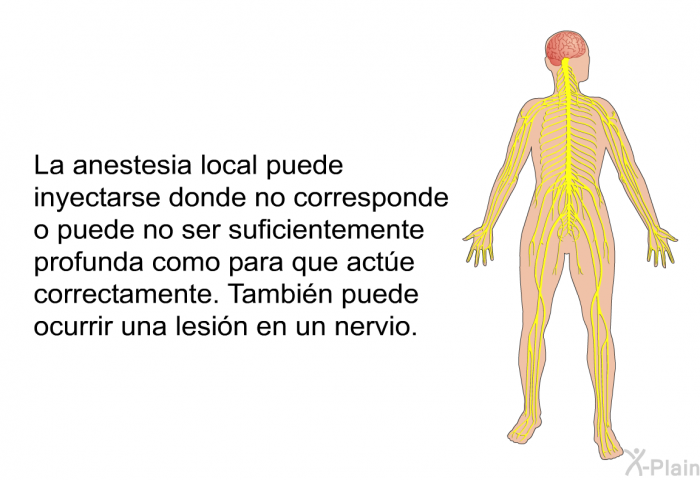 La anestesia local puede inyectarse donde no corresponde o puede no ser suficientemente profunda como para que acte correctamente. Tambin puede ocurrir una lesin en un nervio.