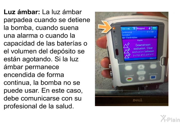 <B>Luz mbar:</B> La luz mbar parpadea cuando se detiene la bomba, cuando suena una alarma o cuando la capacidad de las bateras o el volumen del depsito se estn agotando. Si la luz mbar permanece encendida de forma continua, la bomba no se puede usar. En este caso, debe comunicarse con su profesional de la salud.