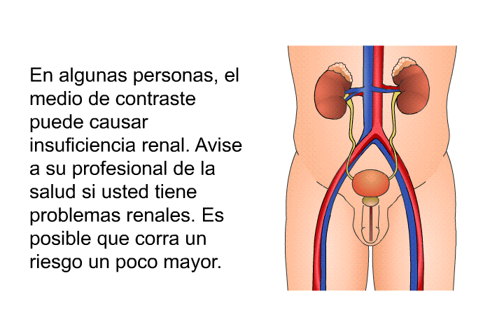 En algunas personas, el medio de contraste puede causar insuficiencia renal. Avise a su profesional de la salud si usted tiene problemas renales. Es posible que corra un riesgo un poco mayor.
